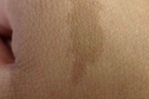 Discover Your Birthmark's Astrological Meaning Safem Fabrication - Precision Engineering & Custom Manufacturing Solutions Discover Your Birthmark's Astrological Meaning | Safem Fabrication - Precision Engineering & Custom Manufacturing Solutions